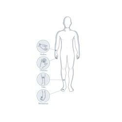 Ostéodensitomètre ultrasons SUNLIGHT MINIOMNI avec sonde CM + logiciel