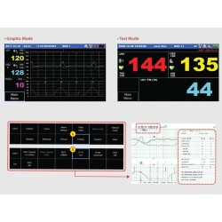 Cardiotocographe gémellaire FC1400 GIMA