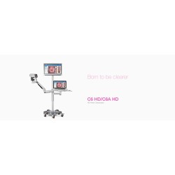 Colposcope Vidéo C6A HD Edan standard+Chariot T-Shape Colposcope Vidéo C6A HD Edan standard+Chariot T-Shape