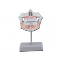 Dentition définitive avec mâchoire adulte inférieure et supérieure