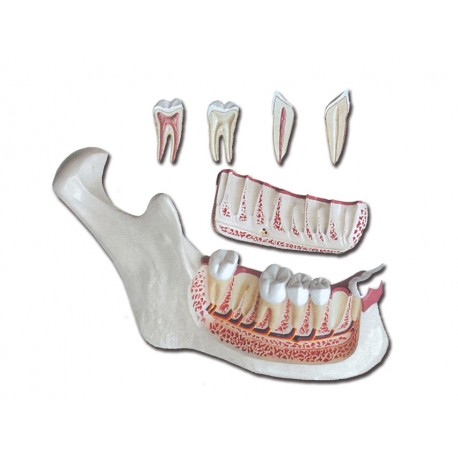Mâchoire inférieure - 6 pièces - 3X
