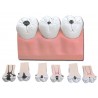 Caries dentaires - 7 pièces - 4X