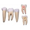 Set de 3 dents : Incisive, Canine, Molaire - 5 pièces - 10X