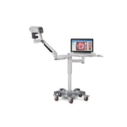 Colposcope Vidéo C6A HD Edan standard+Chariot T-Shape