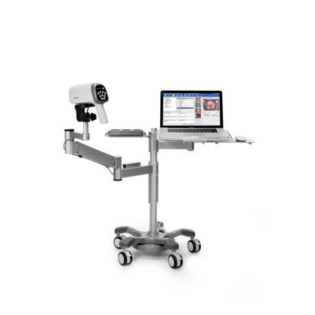 EDAN COLPOSCOPE C3A SWING ARM + PC TRAY