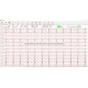 Logiciel pour PC-ECG et Cardiomate (avec clé physique)