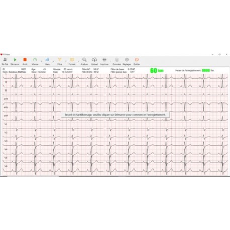 Logiciel pour PC-ECG et Cardiomate (avec clé physique)