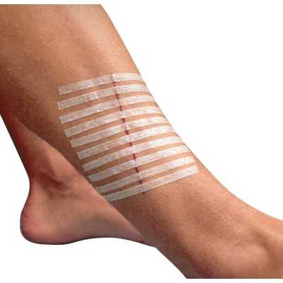 Sutures cutanées 3M STERI-STRIP