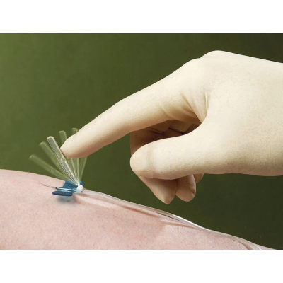 Microperfuseur à ailettes sécurisé Terumo Surflo Surshield avec protecteur d'aiguille