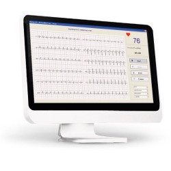 ECG numérique EDAN SE-1010 ECG numérique EDAN SE-1010