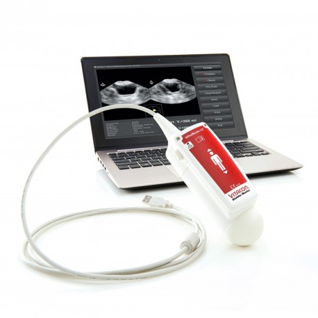 Bladder scanner VITASCAN + logiciel