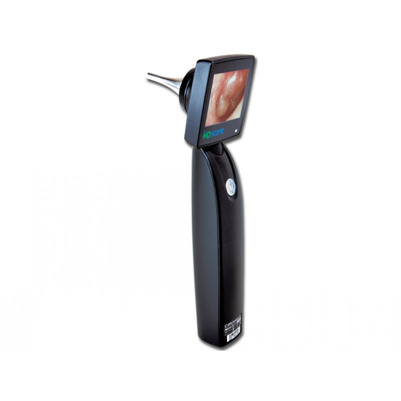 Otoscope vidéo sans fil - CONSOMED