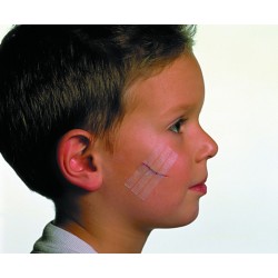 Sutures cutanées 3M STERI-STRIP