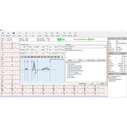Cardiomate PC-ECG Spengler Cardiomate PC-ECG Spengler